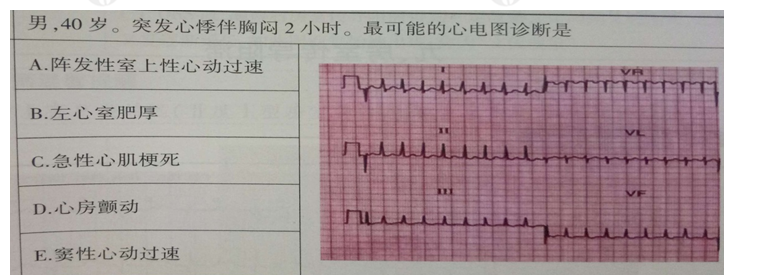 心電圖