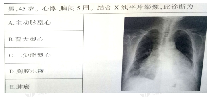 普大型心