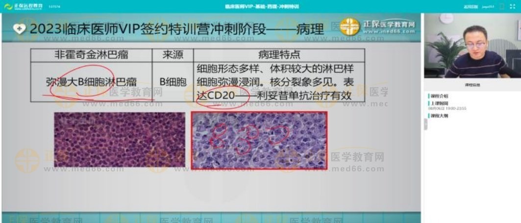 非霍奇金淋巴瘤考點回顧